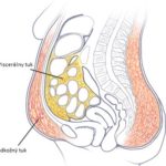 14459345935446-visceral-3